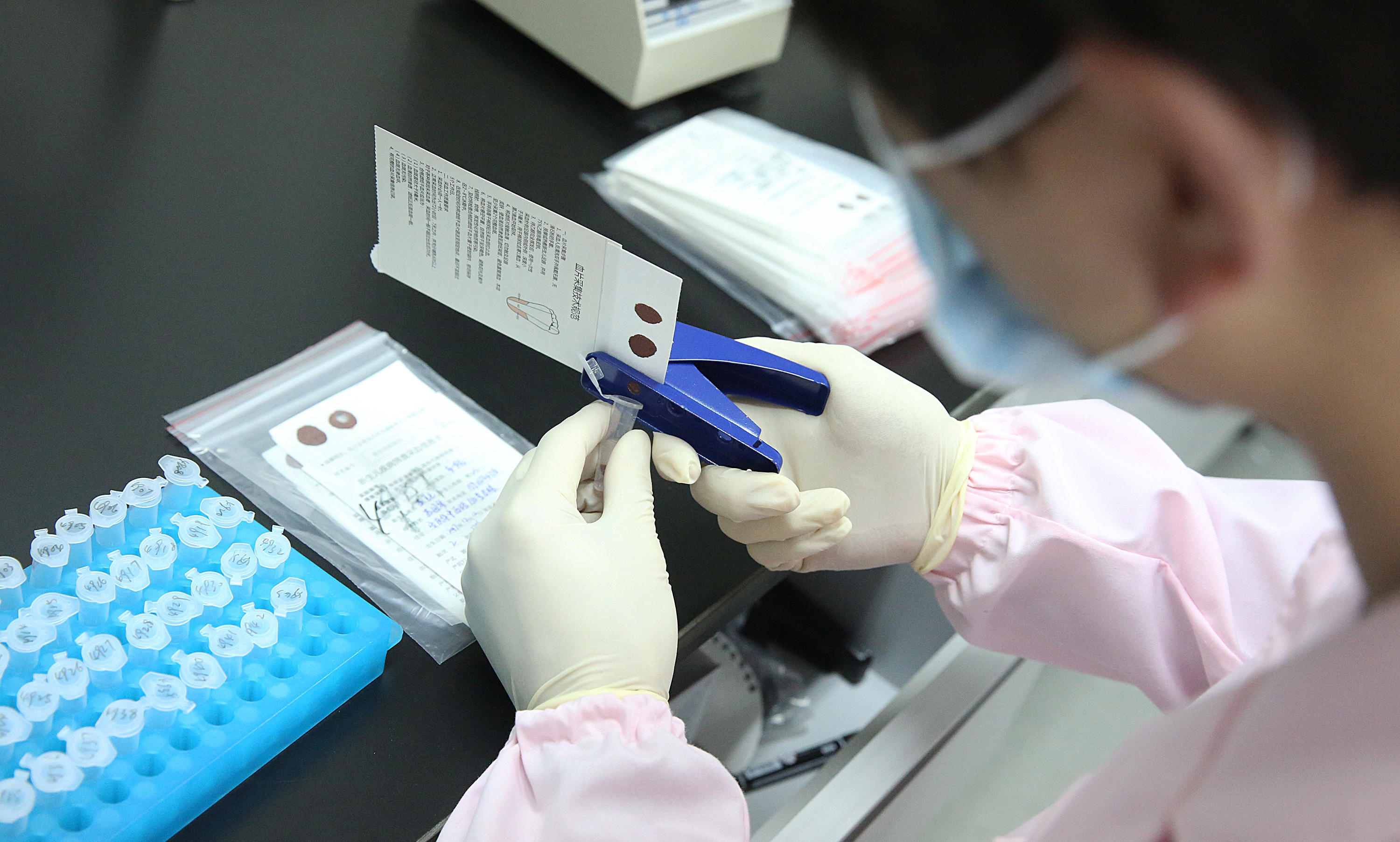 揭秘过程：在重庆做一次亲子鉴定具体需要几步？